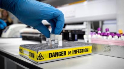 Laois pharmacies experience face mask and hand sanitiser shortage amid Coronavirus outbreak Laois pharmacies experience face mask and hand sanitiser shortage amid Coronavirus outbreak